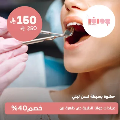 (حشوة بسيطة لسن لبنى)لدى عيادات جوانا الطبية حي ظهرة لبن