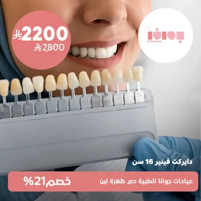 (دايركت فينير 16 سن)لدى عيادات جوانا الطبية حي ظهرة لبن