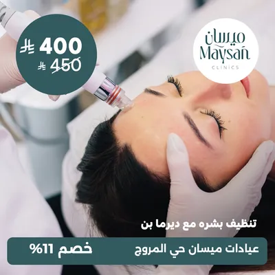 (تنظيف بشره مع ديرما بن) لدى عيادات ميسان حي المروج