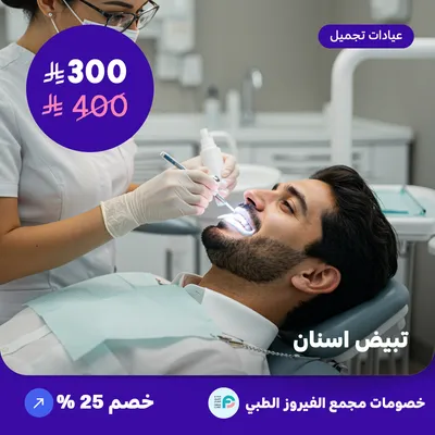 تبييض اسنان (عرض مقدم من مجمع الفيروز الطبي)