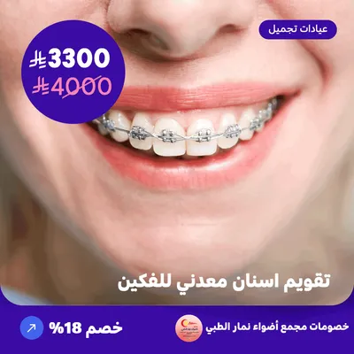 تقويم اسنان معدني للفكين (عرض مقدم من مجمع أضواء نمار الطبي)